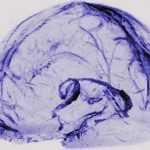 Anthropic Publishes Research on Model Interpretability