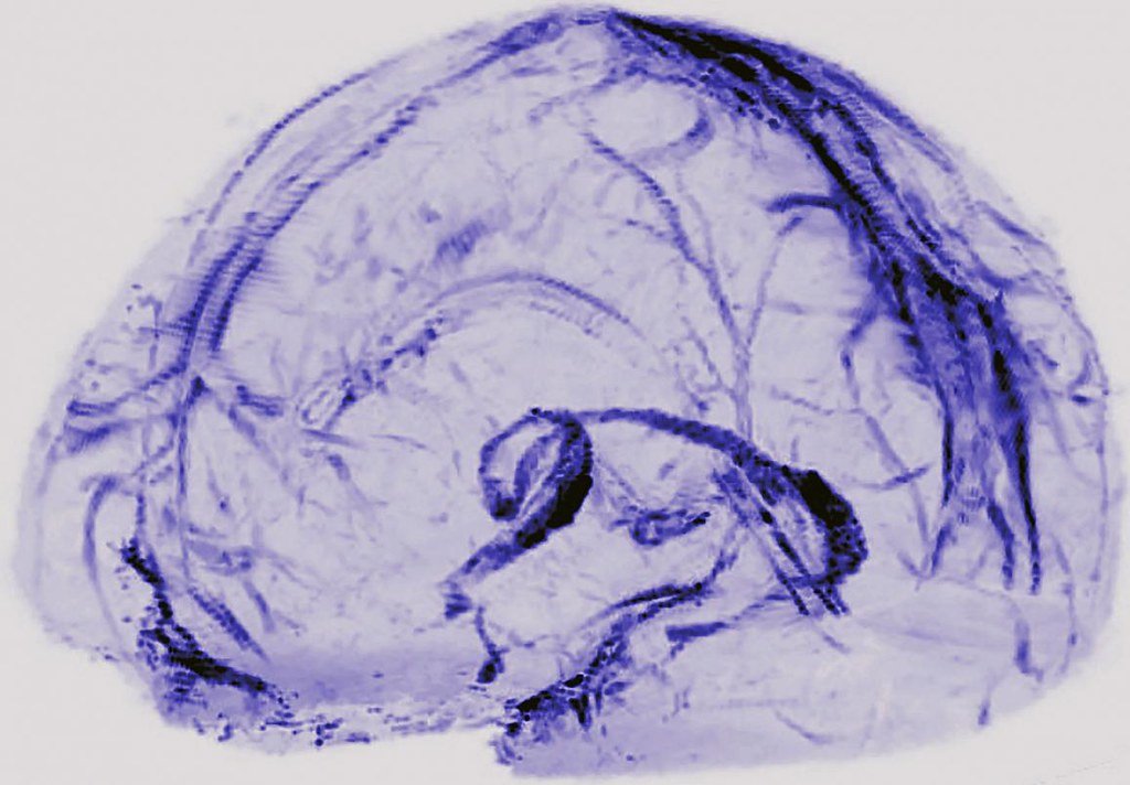 Anthropic Publishes Research on Model Interpretability